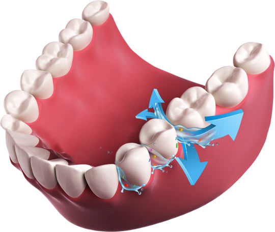 Revodent - Revolution der Interdentalreinigung